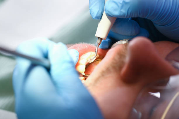 Best Emergency Dental Services for Seniors in Arlington, GA