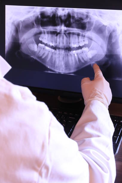 Best Emergency Dentist for Knocked-Out Tooth in Arlington, GA
